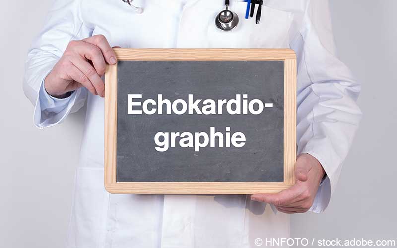 Echokardiographie