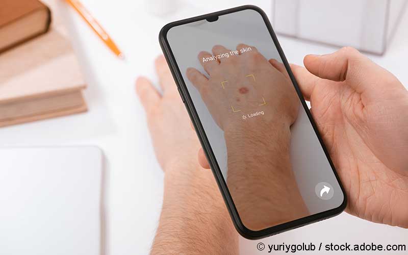 Hautanalyse App Hautanalyse App