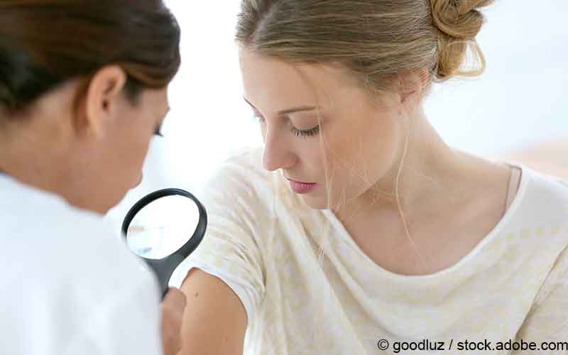 Hautkrebsvorsorge junge Frau