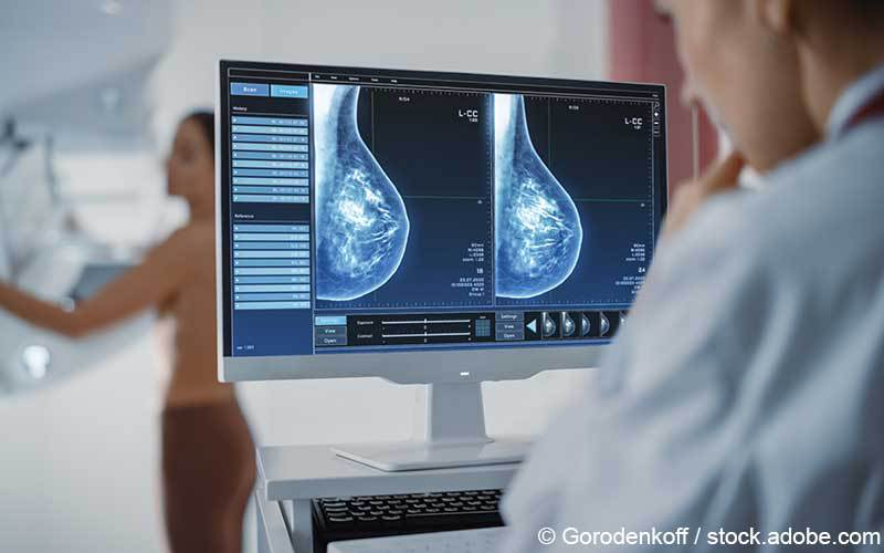 Mammographie Diagnostik Mammographie Diagnostik