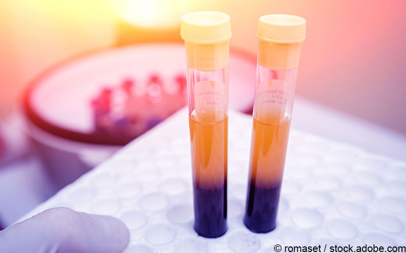 Plasma Zentrifuge Plasma Zentrifuge