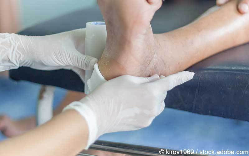 Diabetischer Fuss Diabetischer Fuss