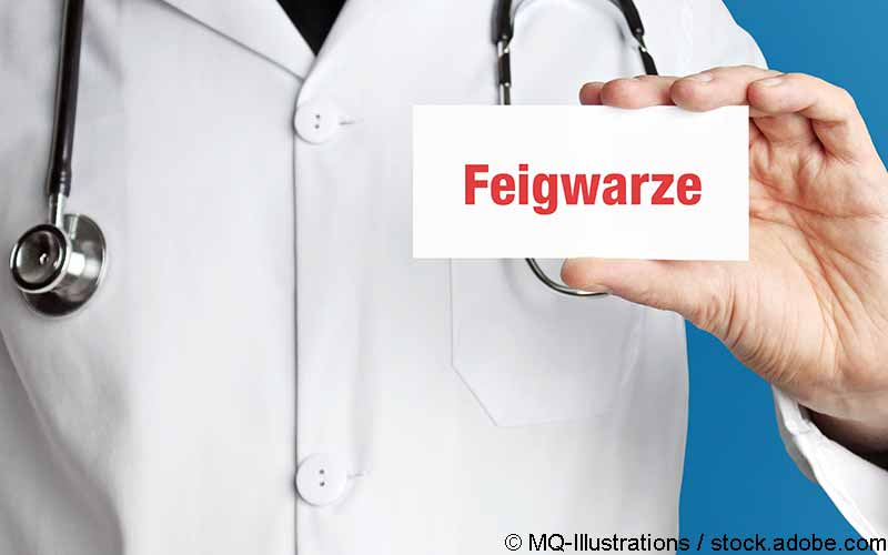 Feigwarze