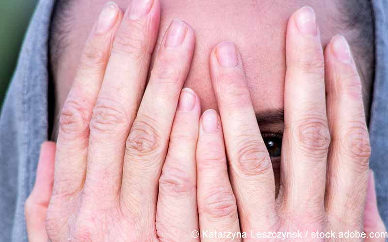 Frau atopische Dermatitis Gesicht