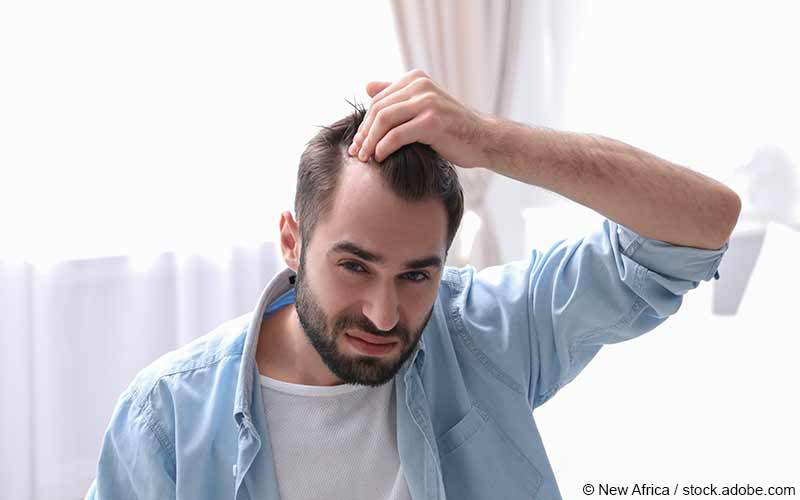 Haarausfall Mann Haarausfall Mann
