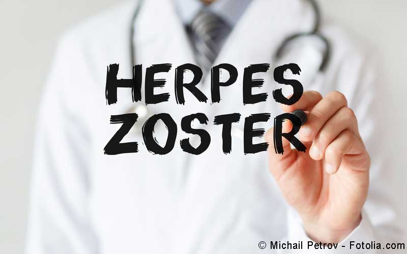 Herpes zoster Herpes zoster