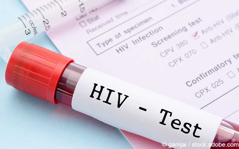 HIV-Test