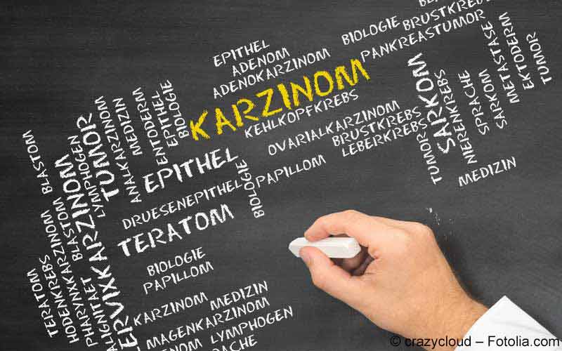 Karzinom Karzinom