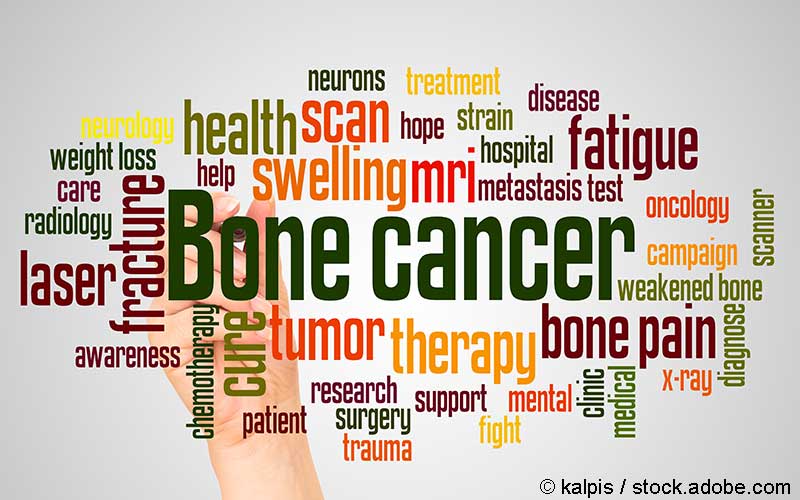 Knochenkrebs