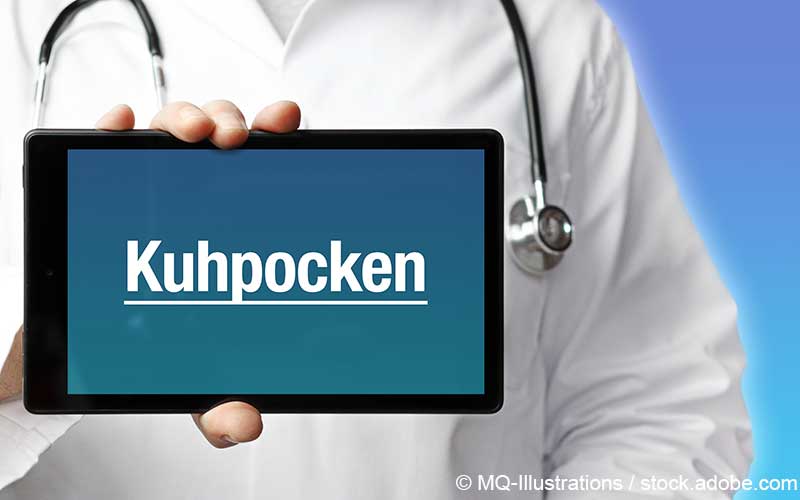Kuhpocken