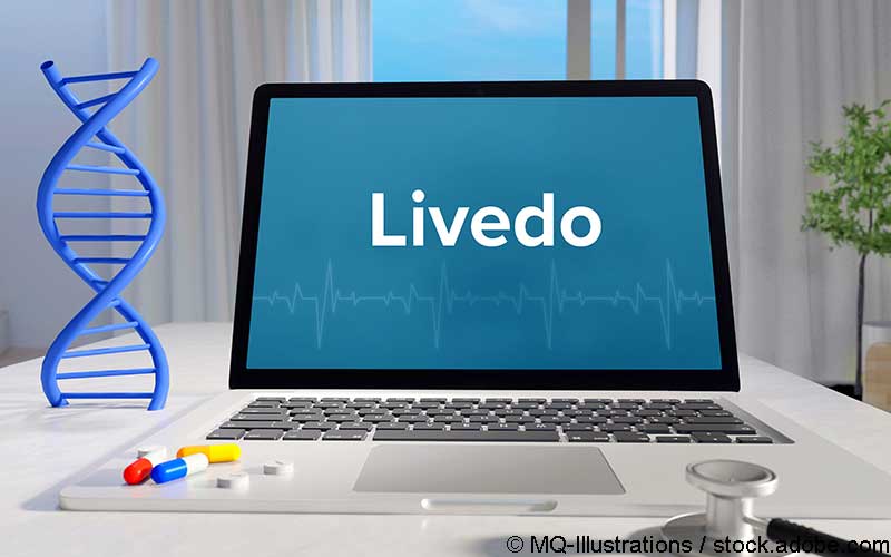 Livedo