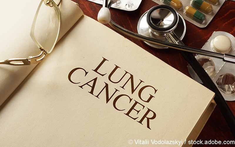 Lungenkrebs Schriftzug Buch