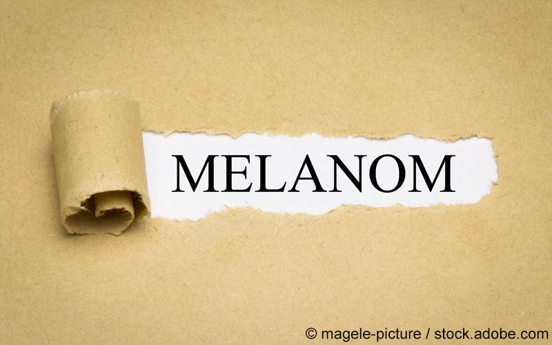 Melanom Schriftzug Melanom Schriftzug