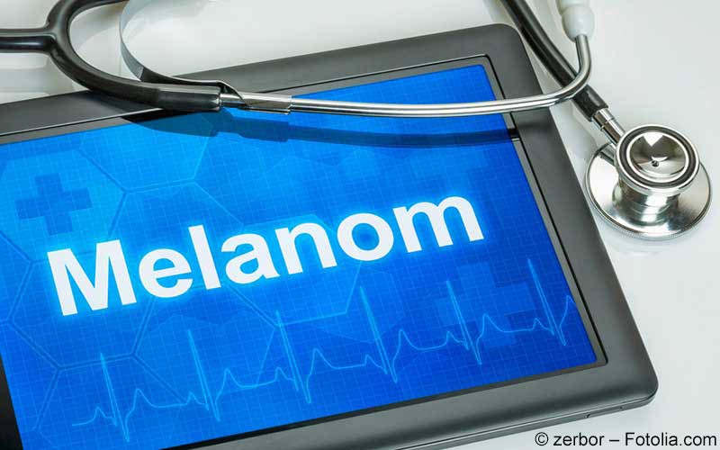 Melanom Melanom