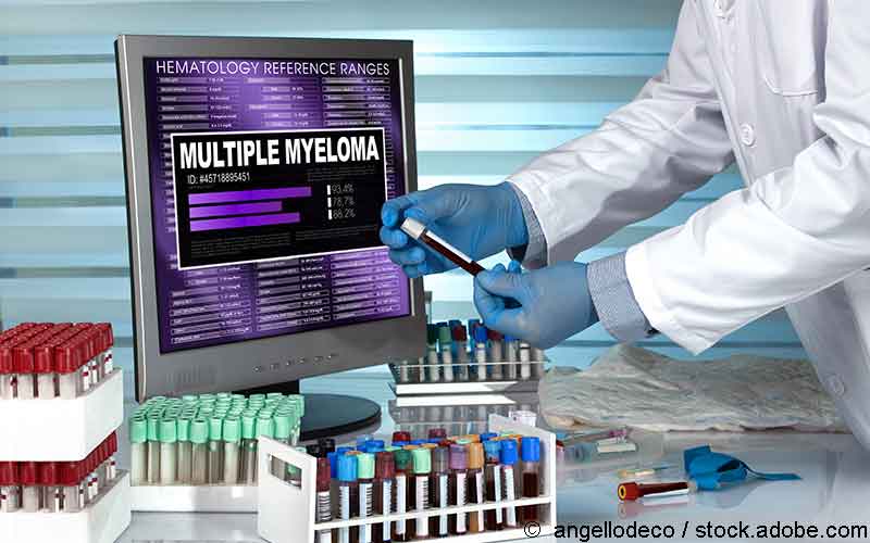 Multiples Myelom