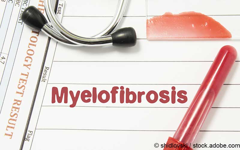 Myelofibrose