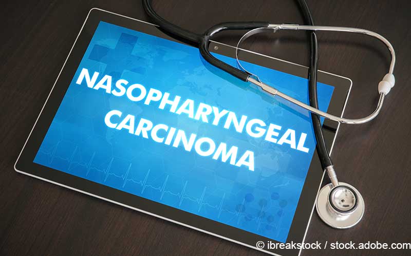 Nasopharyngealkarzinom