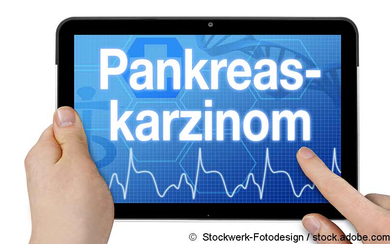 Pankreaskarzinom Schriftzug