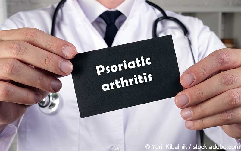 Psoriasis Arthritis