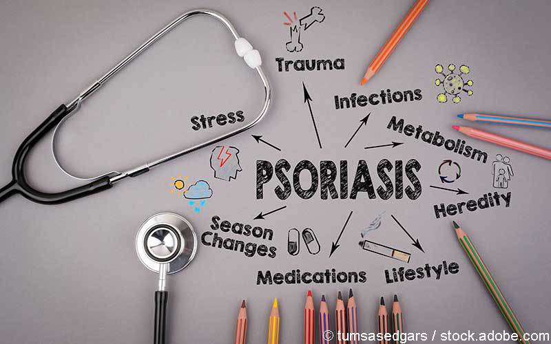 Psoriasis Risikofaktoren Psoriasis Risikofaktoren