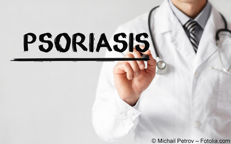 Psoriasis Psoriasis