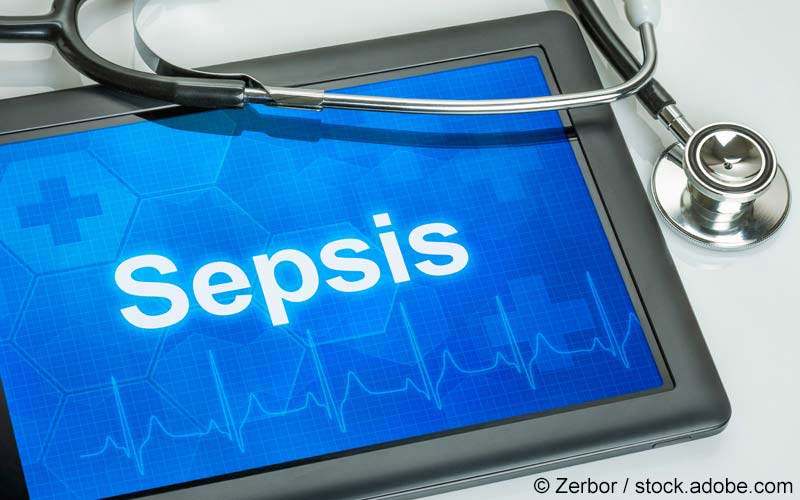 Sepsis Sepsis