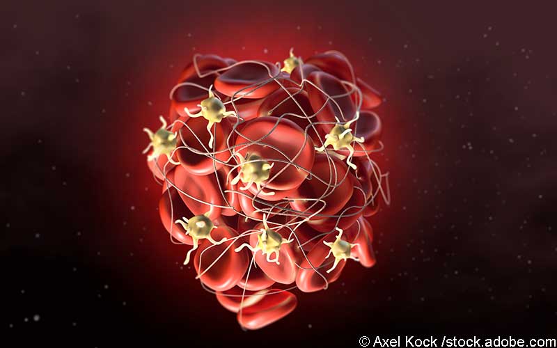 Thrombus Thrombus