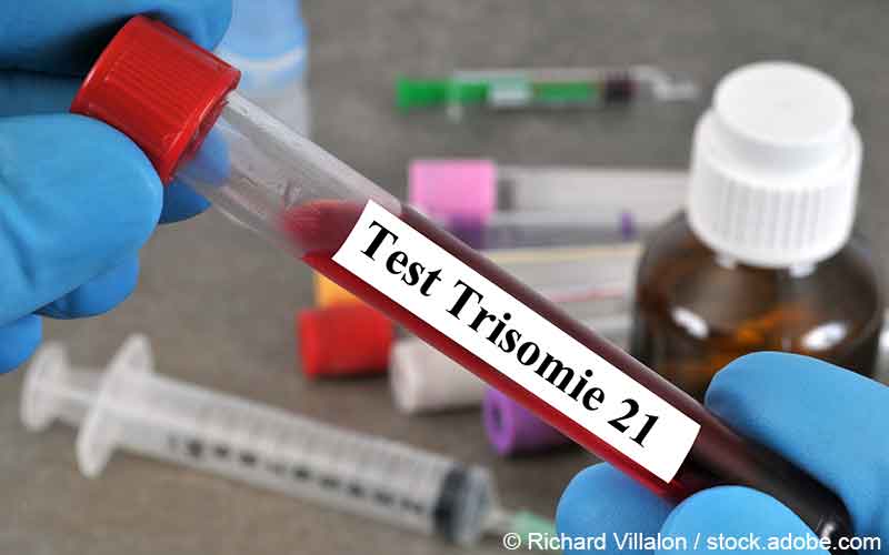 Trisomie-21 Bluttest Trisomie-21 Bluttest