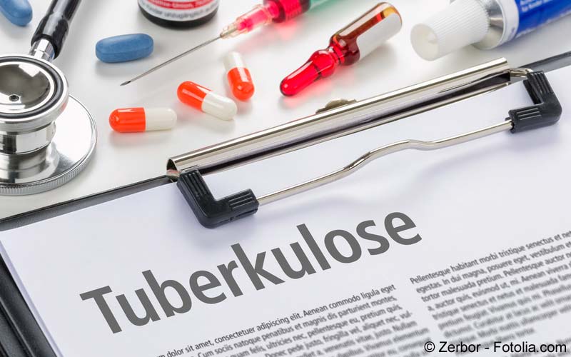 die behandlung der tuberkulosen meningitis bei erwachsenen