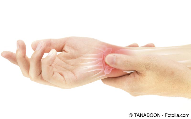 Rheumatoid arthritis a csuklóban: tünetek, kezelés és gyakorlatok