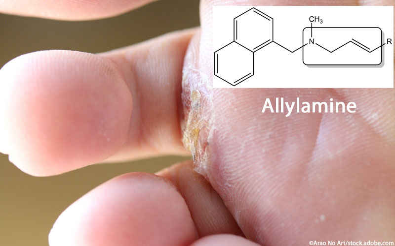 Allylamine Allylamine