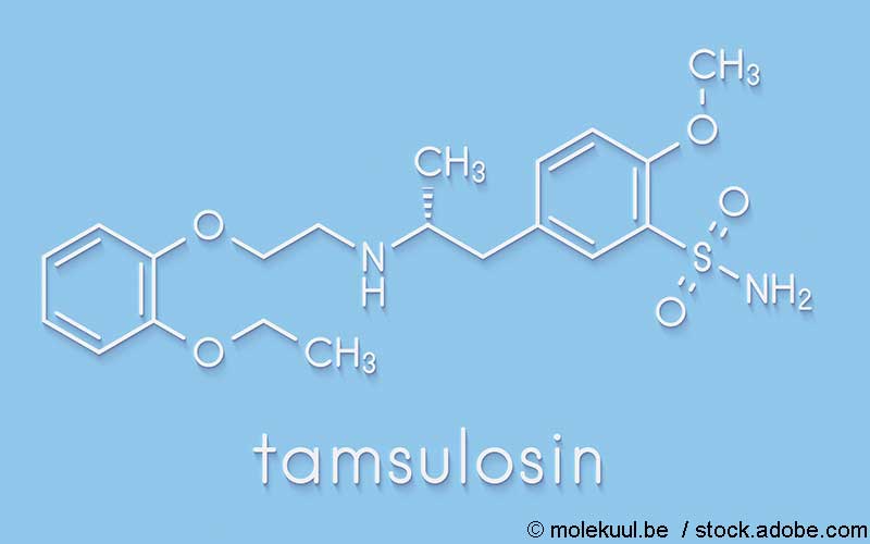 Tamsulosin