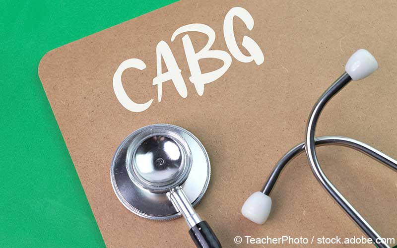 CABG CABG