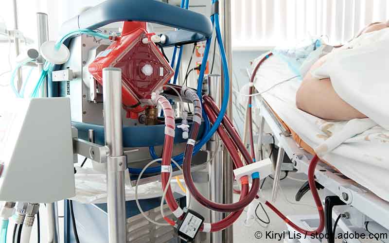 ecmo ecmo